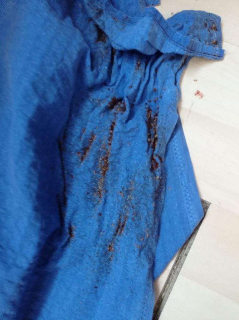 pluskwa domowa – zwalczanie pluskiew Sokołów Podlaski